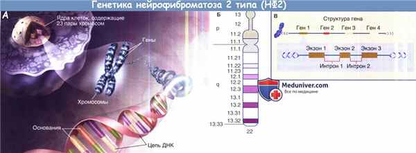 Генетика нейрофиброматоза 2 типа (НФ2)