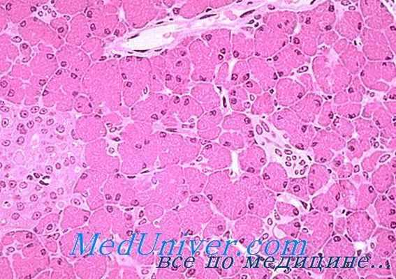 гиперинсулинизм