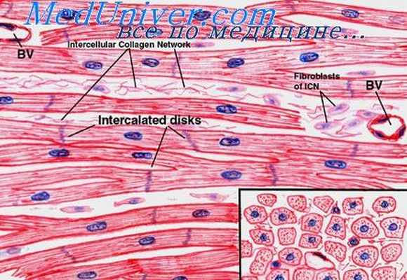 морфология острой и хронической сердечной недостаточности
