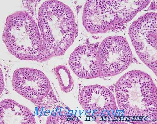 крипторхизм