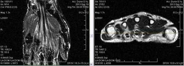 МРТ кисти: когда назначается?