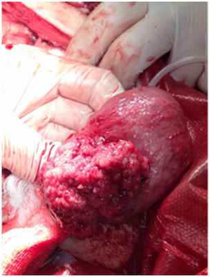 Переходно-клеточная карцинома мочевого пузыря у собаки 