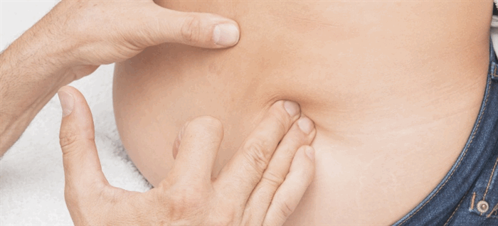 Невропатия бедренного нерва