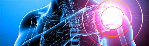 МРТ плечевого сплетения