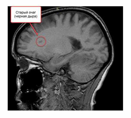 Старый очаг (черная дыра)