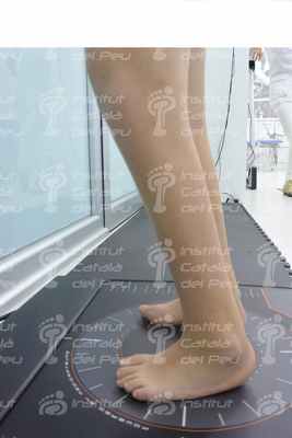 Синдром каудальной регрессии: причины и наиболее распространенные аномалии