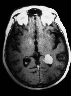 внутрижел-контр-акс