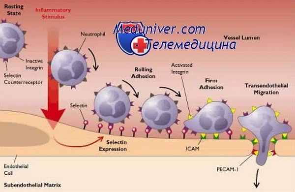 недостаточность адгезии лейкоцитов