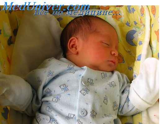 недостаточность клапана у новорожденного