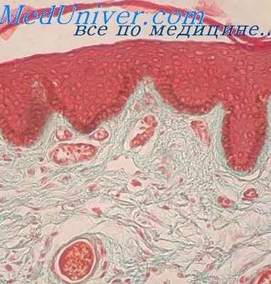 фринодерма