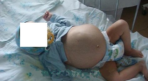 Клиническая картина