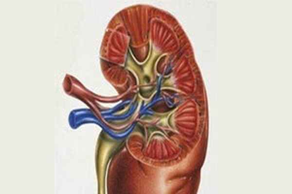 Почка в разрезе при нефротическом синдроме
