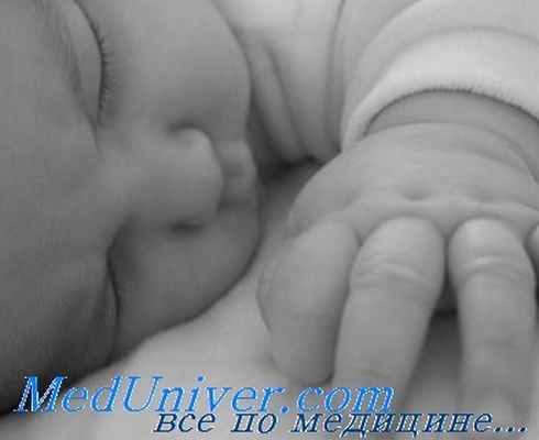 судороги новорожденных