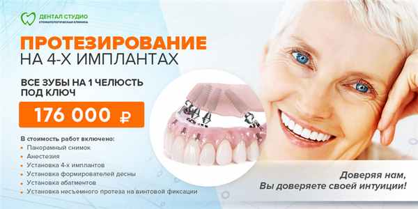Несъемное протезирование на 4-х имплантах