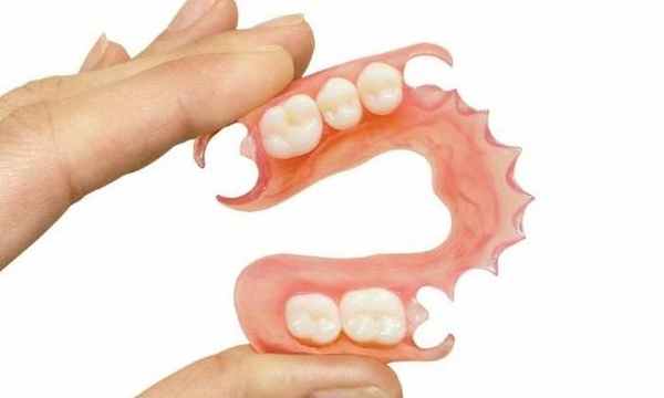 нейлоновые протезы или пластмассовые фото 