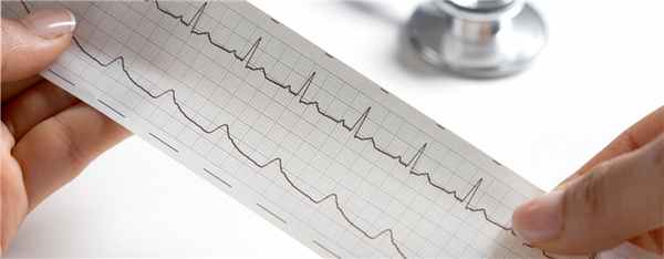 Электрокардиография (ЭКГ)