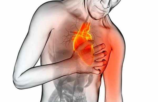 Нестабильная стенокардия