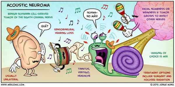 Механизм развития невриномы слухового нерва