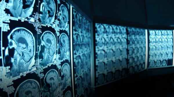 кто такой невролог 4