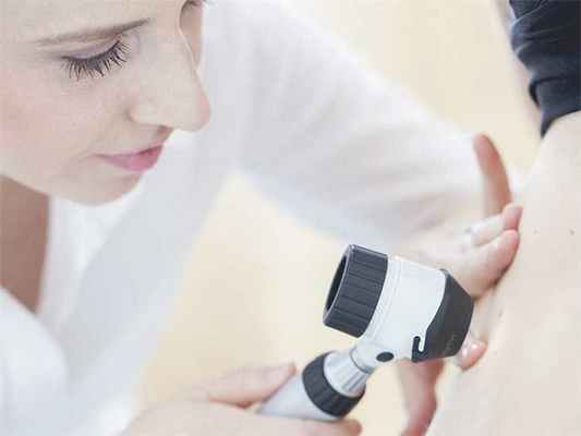 голубой невус удаление