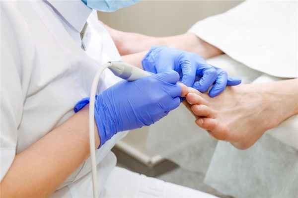 Меланома ногтя