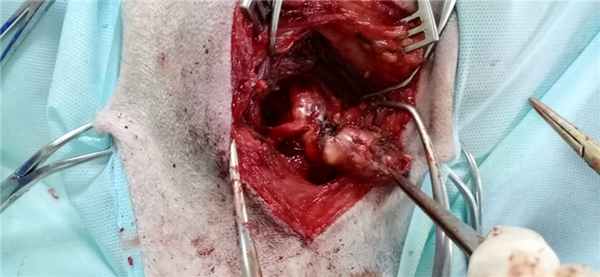 опухоль периферических нервов