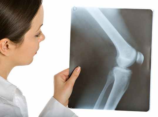 Артропатия