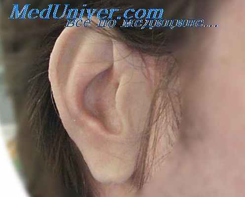 травматический отит