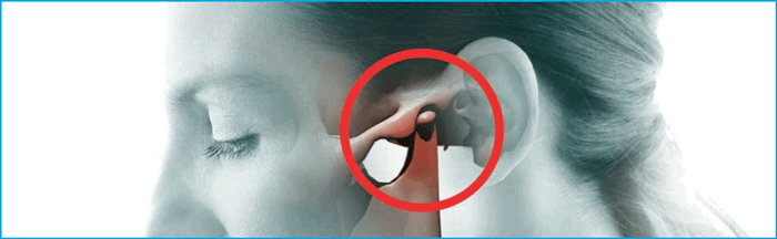 Лечение височно-нижнечелюстного сустава