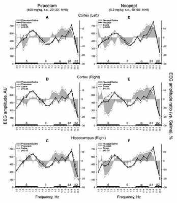 Ноотропные препараты