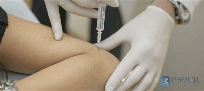 Как проводят блокаду локтевого сустава?