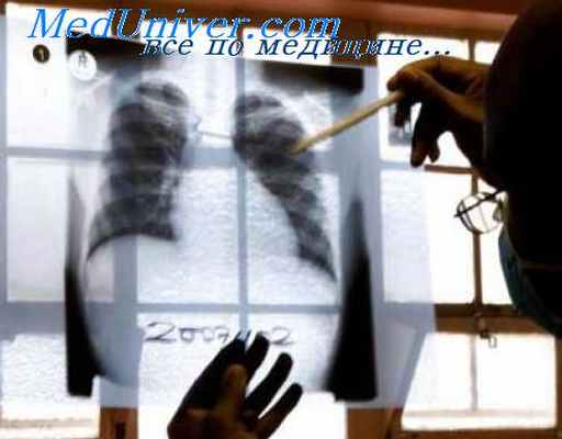 инфильтративный туберкулез