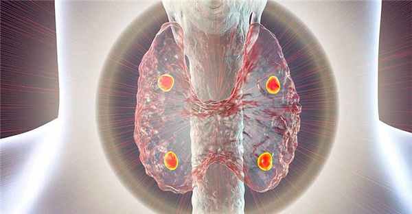 Соседствуя с щитовидной железой: что такое паращитовидные железы?