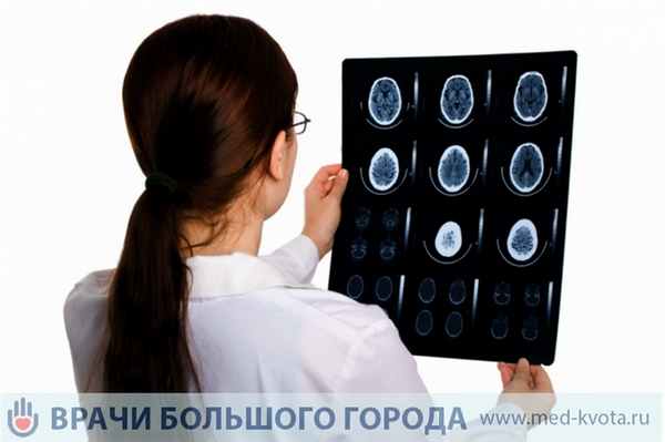 Диагностика глиомы ствола головного мозга