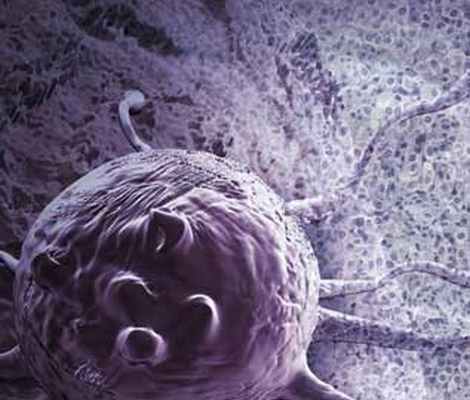 Онкологические заболевания и способы лечения