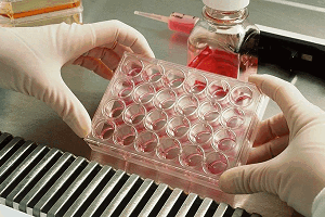 Диагностика онхоцеркоза