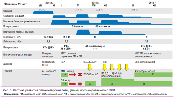 Рис. 3. Картина развития оптиконевромиелита Девика, ассоциированного с СКВ.