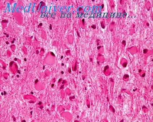 гипоталамус