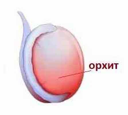 орхит