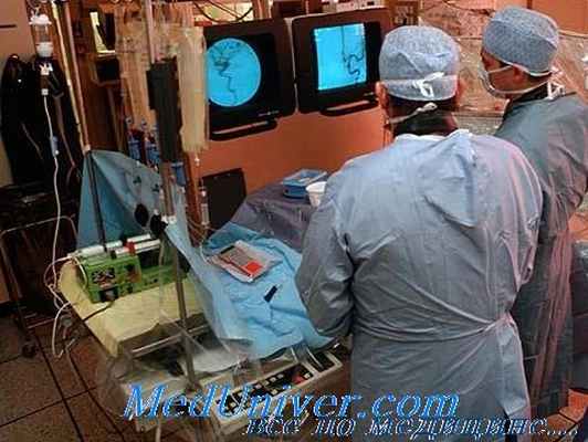 эмболизация внутримозговых аневризм