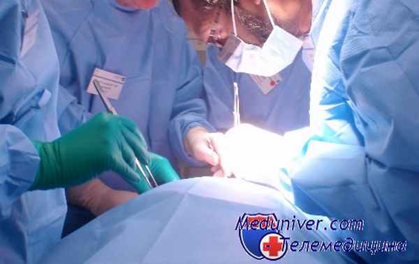 симпатэктомия