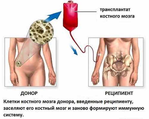 лечение мраморной болезни