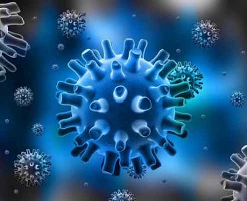 Фото Интерстициальная пневмония