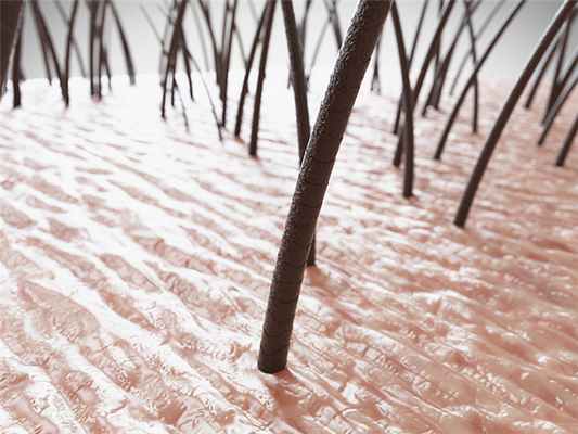 Фотодерматозы, фото