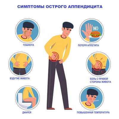 Симптомы аппендицита.jpg