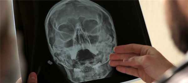 КТ и рентген гайморовых пазух