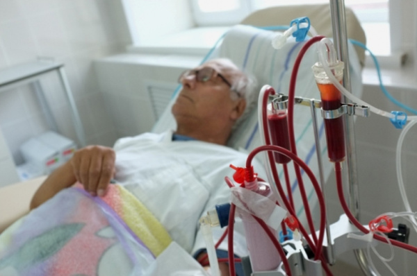 Гемодиализ