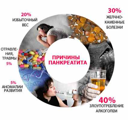Основные причины острого панкреатита