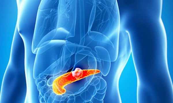 Острый панкреатит: диагностика и лечение заболевания