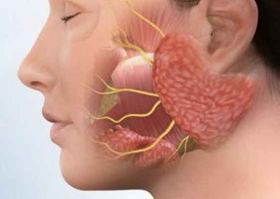 воспаление слюнных желёз рисунок